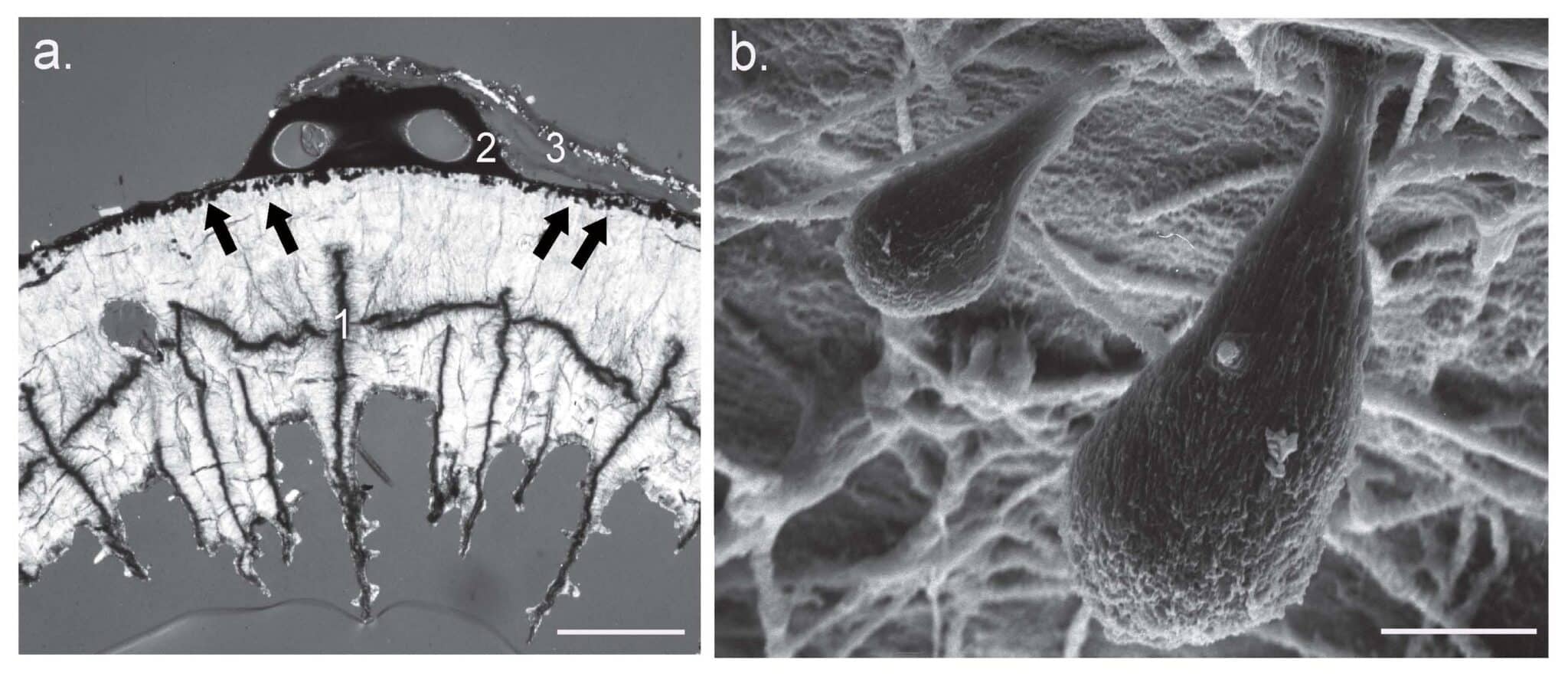Cold-water Corals (Cambridge University Press) © 2009 JM Roberts, A Wheeler, A Freiwald and S Cairns Figure downloaded from www.lophelia.org/cold-water-corals-book